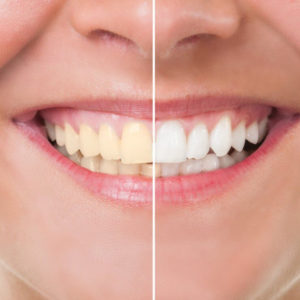 Clínica Dental Cartagena - Clínica Dental Vidal