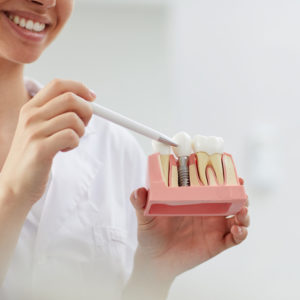 Clínica Dental Cartagena - Clínica Dental Vidal
